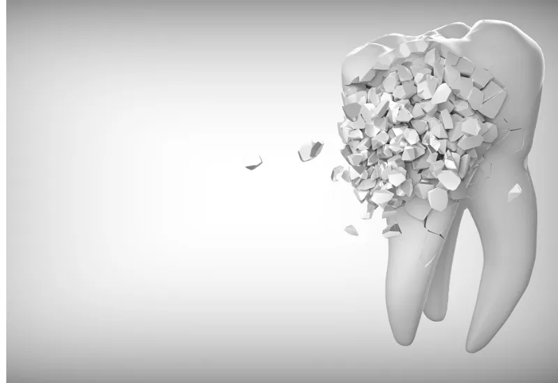 Dental Tooth Fractures in Fremont, CA