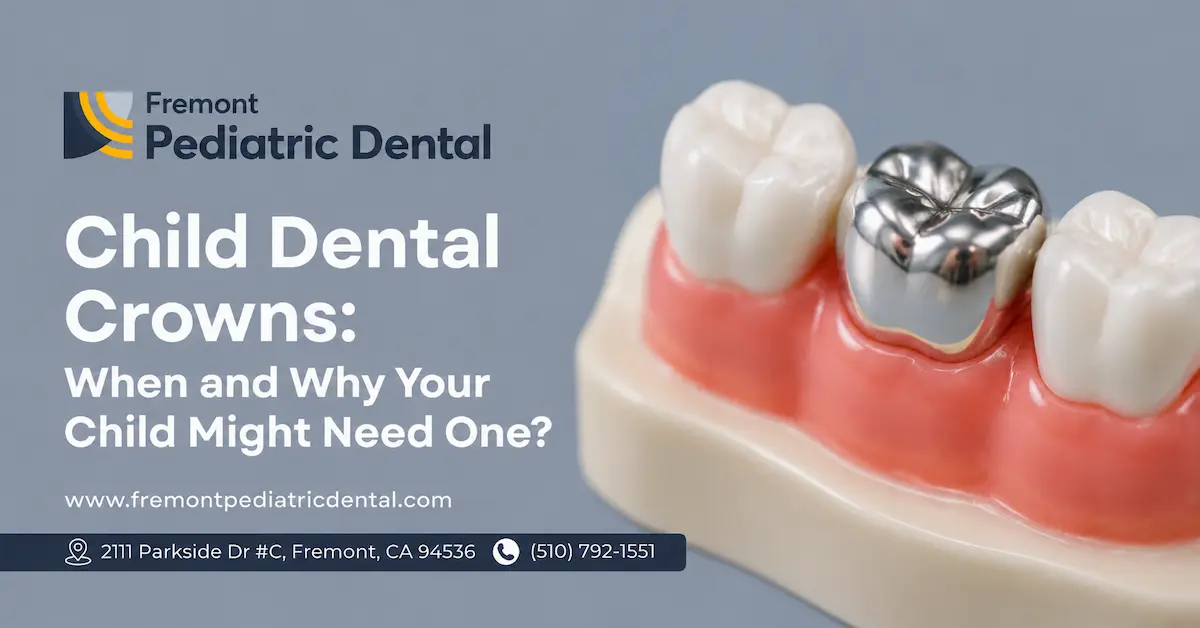 Child Dental Crowns: When and Why Your Child Might Need One?